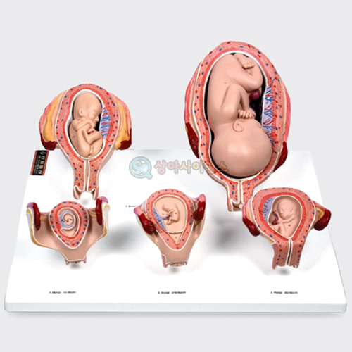태아발육 과정A형